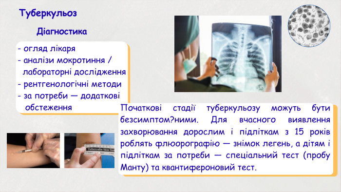 Туберкульоз. Діагностика - огляд лікаря- аналізи мокротиння / лабораторні дослідження- рентгенологічні методи- за потреби — додаткові обстеження. Початкові стадії туберкульозу можуть бути безсимптом?ними. Для вчасного виявлення захворювання дорослим і підліткам з 15 років роблять флю­орографію — знімок легень, а дітям і підліткам за потреби — спеціаль­ний тест (пробу Манту) та квантифероновий тест.
