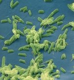 http://www.epidemiolog.ru/upload/medialibrary/568/bacteria.jpg