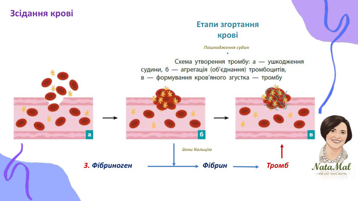 Nata. Malтвій світ твоє життя ֍ ֍ ֍ Етапи згортання кровіПошкодження судин1. Тромбоцити. Тромбопластинбілок - ферментсолі Кальцію, вітамін К2. Протромбін Тромбінутворюється в печінціферментйони Кальцію3. Фібриноген Фібрин. Зсідання крові Тромб