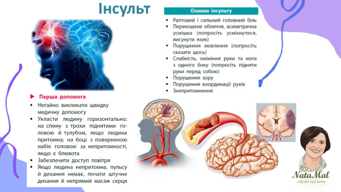 Nata. Malтвій світ твоє життя ֍ ֍ ֍ Інсульт