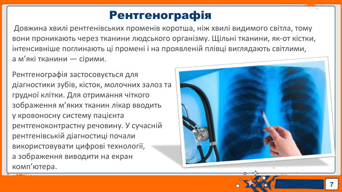 7 Рентгенографія Довжина хвилі рентгенівських променів коротша, ніж хвилі видимого світла, тому вони проникають через тканини людського організму. Щільні тканини, як-от кістки, інтенсивніше поглинають ці промені і на проявленій плівці виглядають світлими, а м’які тканини — сірими. Рентгенографія застосовується для діагностики зубів, кісток, молочних залоз та грудної клітки. Для отримання чіткого зображення м’яких тканин лікар вводить у кровоносну систему пацієнта рентгеноконтрастну речовину. У сучасній рентгенівській діагностиці почали використовувати цифрові технології, а зображення виводити на екран комп’ютера.