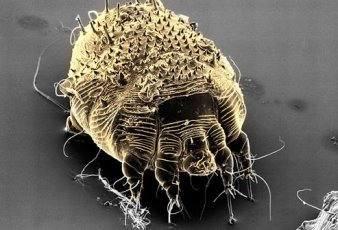 C:\Users\User\Downloads\photolibrary_rf_photo_of_scabies_mite.jpg
