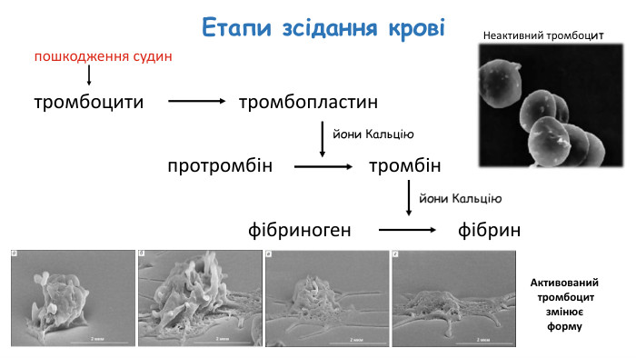 Етапи зсідання кровітромбоцитипошкодження судинтромбопластинйони Кальціюпротромбінтромбінфібриногенфібрин. Неактивний тромбоцит. Активований тромбоцитзмінюєформу