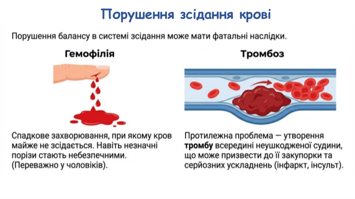 Порушення зсідання крові