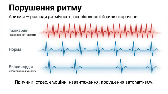Причини: стрес, емоційні навантаження, порушення автоматизму.