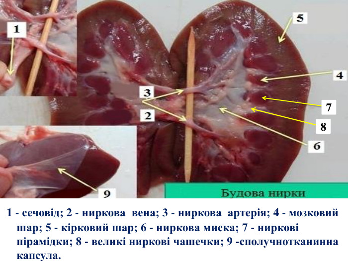  1 - сечовід; 2 - ниркова вена; 3 - ниркова артерія; 4 - мозковий шар; 5 - кірковий шар; 6 - ниркова миска; 7 - ниркові пірамідки; 8 - великі ниркові чашечки; 9 -сполучнотканинна капсула.78