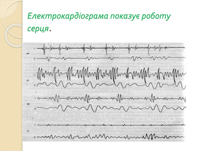Електрокардіограма показує роботу серця.
