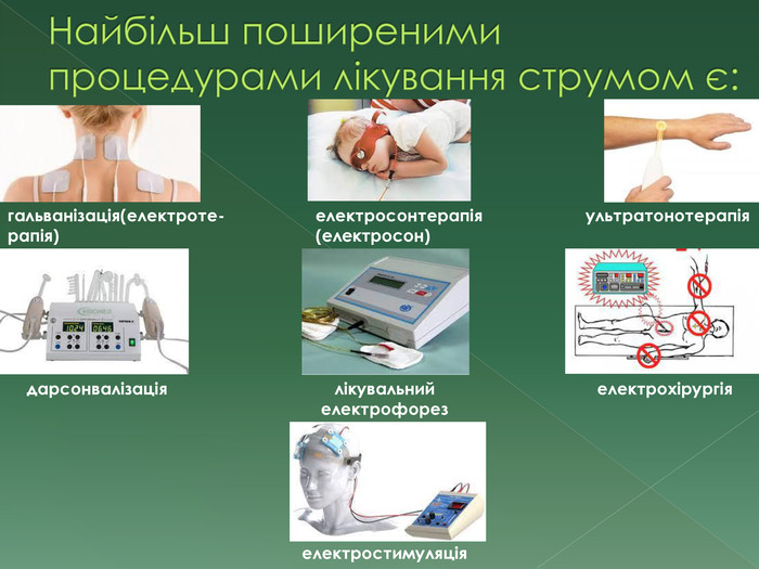Найбільш поширеними процедурами лікування струмом є:гальванізація(електроте-рапія) електросонтерапія (електросон) ультратонотерапіядарсонвалізаціялікувальний електрофорезелектрохірургіяелектростимуляція