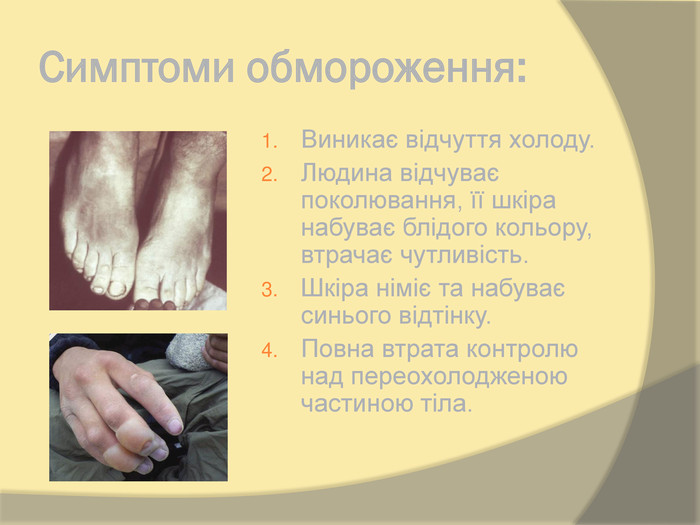 Реферат: Гігієна шкіри Перша допомога при обмороженнях і опіках