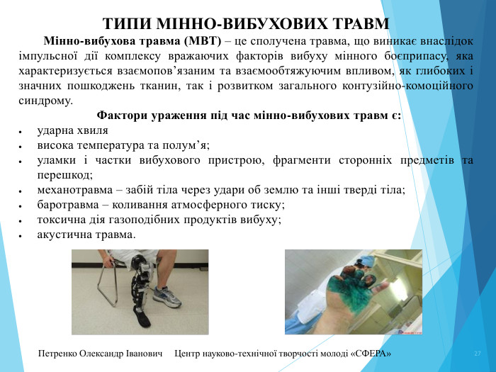 27 Петренко Олександр Іванович Центр науково-технічної творчості молоді «СФЕРА» ТИПИ МІННО-ВИБУХОВИХ ТРАВМ	Мінно-вибухова травма (МВТ) – це сполучена травма, що виникає внаслідок імпульсної дії комплексу вражаючих факторів вибуху мінного боєприпасу, яка характеризується взаємопов’язаним та взаємообтяжуючим впливом, як глибоких і значних пошкоджень тканин, так і розвитком загального контузійно-комоційного синдрому.  Фактори ураження під час мінно-вибухових травм є:ударна хвилявисока температура та полум’я;уламки і частки вибухового пристрою, фрагменти сторонніх предметів та перешкод;механотравма – забій тіла через удари об землю та інші тверді тіла;баротравма – коливання атмосферного тиску;токсична дія газоподібних продуктів вибуху;акустична травма.