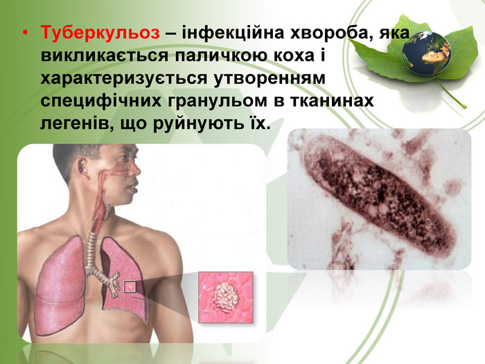 Туберкульоз – інфекційна хвороба, яка викликається паличкою коха і характеризується утворенням специфічних гранульом в тканинах легенів, що руйнують їх. 