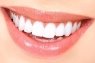 Woman teeth | Отбелить зубы, Белые зубы, Зубы