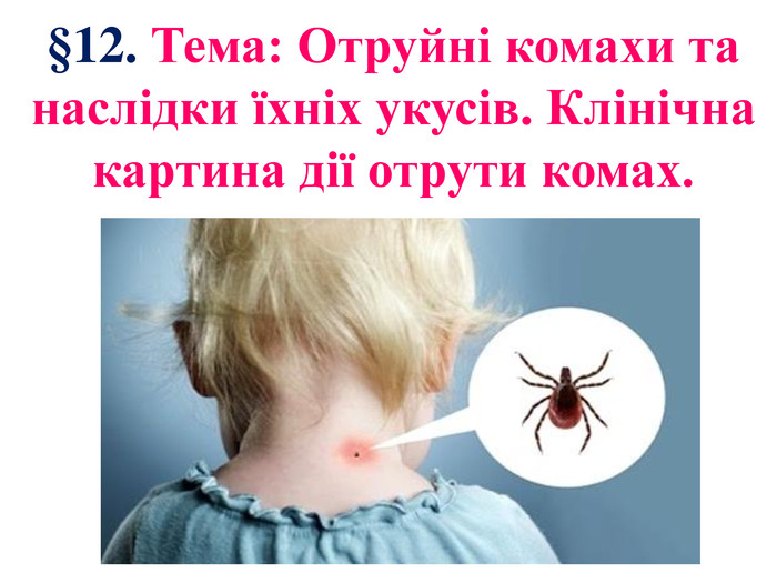§12. Тема: Отруйні комахи та наслідки їхніх укусів. Клінічна картина дії отрути комах.