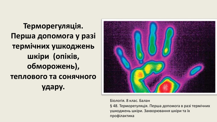 Терморегуляція. Перша допомога у разі термічних ушкоджень шкіри (опіків, обморожень), теплового та сонячного удару. Біологія. 8 клас. Балан§ 48. Терморегуляція. Перша допомога в разі термічних ушкоджень шкіри. Захворювання шкіри та їх профілактика