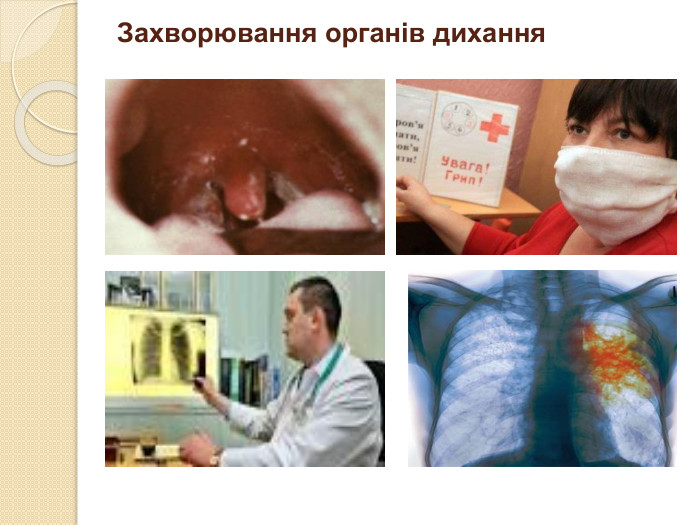 Захворювання органів дихання 