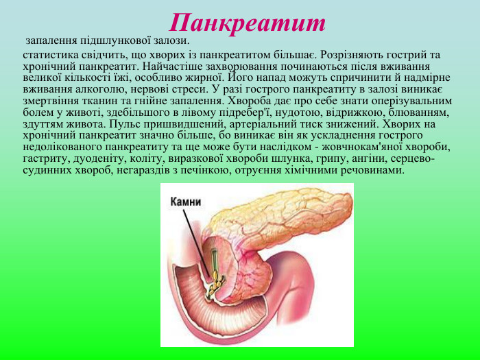 Панкреатит        запалення підшлункової залози.        статистика свідчить, що хворих із панкреатитом більшає. Розрізняють гострий та хронічний панкреатит. Найчастіше захворювання починаються після вживання великої кількості їжі, особливо жирної. Його напад можуть спричинити й надмірне вживання алкоголю, нервові стреси. У разі гострого панкреатиту в залозі виникає змертвіння тканин та гнійне запалення. Хвороба дає про себе знати оперізувальним болем у животі, здебільшого в лівому підребер'ї, нудотою, відрижкою, блюванням, здуттям живота. Пульс пришвидшений, артеріальний тиск знижений. Хворих на хронічний панкреатит значно більше, бо виникає він як ускладнення гострого недолікованого панкреатиту та ще може бути наслідком - жовчнокам'яної хвороби, гастриту, дуоденіту, коліту, виразкової хвороби шлунка, грипу, ангіни, серцево-судинних хвороб, негараздів з печінкою, отруєння хімічними речовинами.  