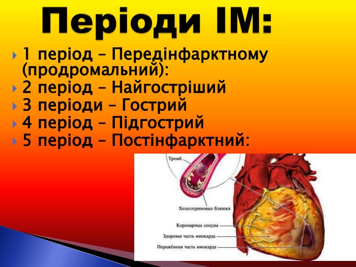 1 період – Передінфарктному (продромальний):  2 період – Найгостріший 3 періоди – Гострий 4 період – Підгострий 5 період – Постінфарктний: 