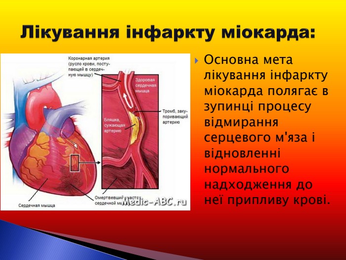 Основна мета лікування інфаркту міокарда полягає в зупинці процесу відмирання серцевого м'яза і відновленні нормального надходження до неї припливу крові.  