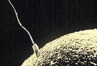 http://upload.wikimedia.org/wikipedia/commons/thumb/8/86/Sperm-egg.jpg/200px-Sperm-egg.jpg