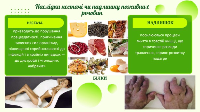 Наслідки нестачі чи надлишку поживних речовин. НАДЛИШОКНЕСТАЧАпосилюються процеси гниття в товстій кишці, що спричиняє розлади травлення, сприяє розвитку подагрипризводить до порушення працездатності, пригнічення захисних сил організму, підвищеної сприйнятливості до інфекцій і в крайніх випадках — до дистрофії і «голодних набряків»БІЛКИ