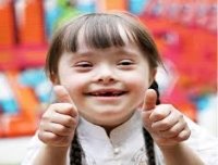 ᐈ Funny down syndrome stock images, Royalty Free downs photos | download on  Depositphotos®